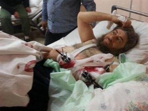 16 aprile 2014. Il comandante del Daesh Abu Muhammad, ferito in combattimento, viene curato all’ospedale statale di Hatay (fonte: Daily News).