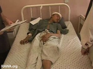 Ottobre 2006. Quattordicenne ferito dai bombardamenti NATO a Panjwaye. Fonte: RAWA.